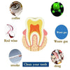 Tooth Whitening Instrument - Shop-bestdealz